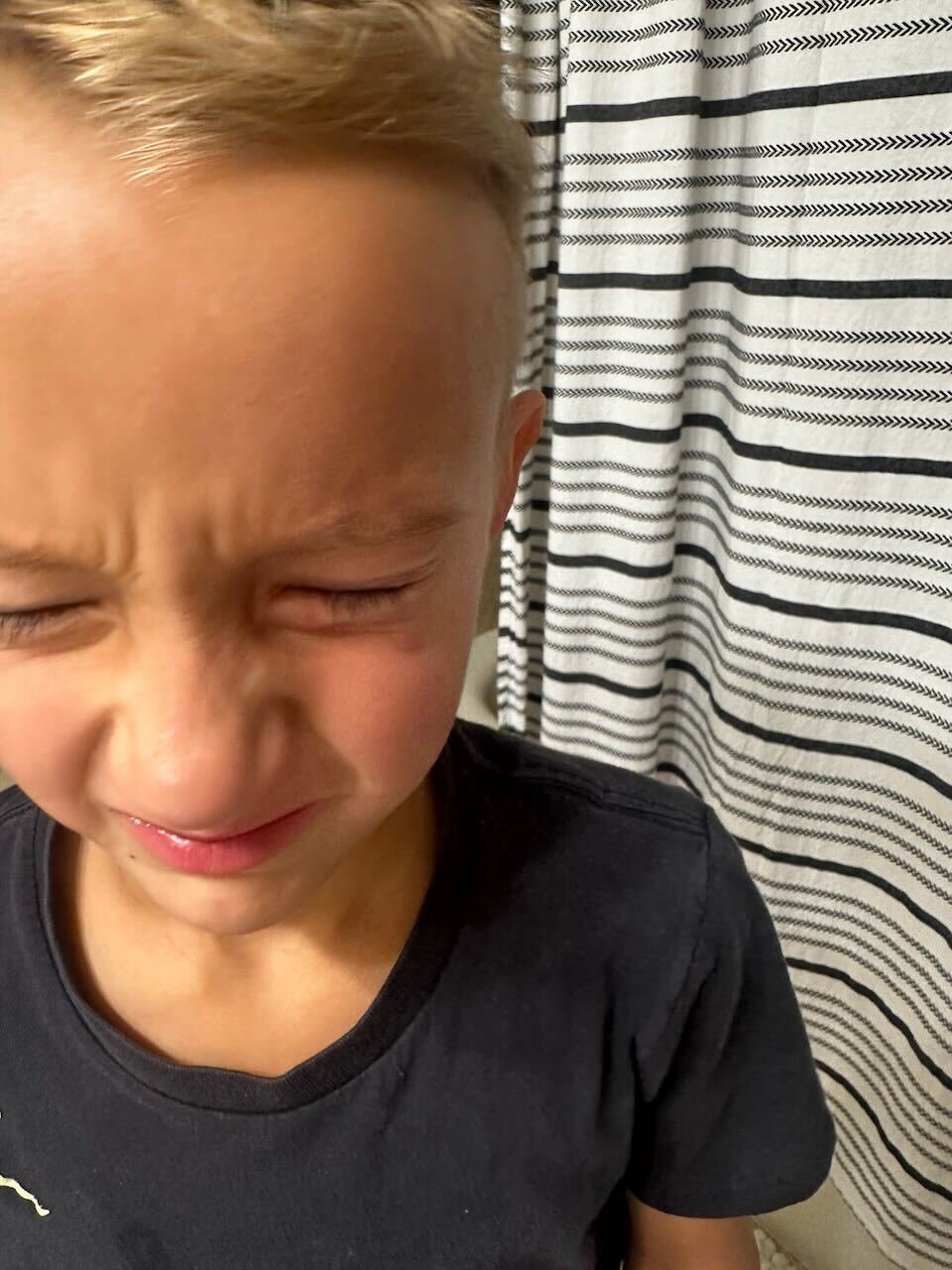 Gage Bee Sting